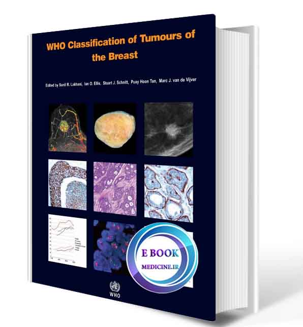 دانلود کتابWHO Classification of Tumours of the Breast  (ORIGINAL PDF)